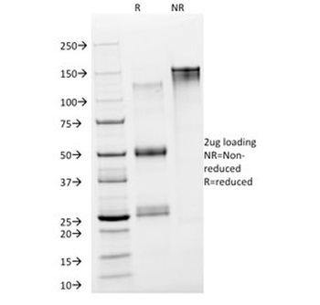 NSE Antibody / Neuron Specific Enolase