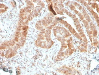 AKT1 Antibody