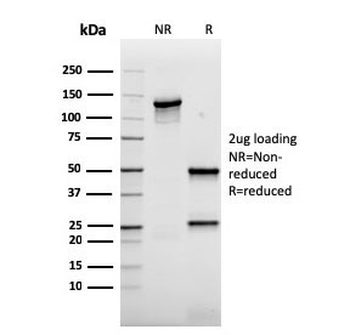 AKT1 Antibody