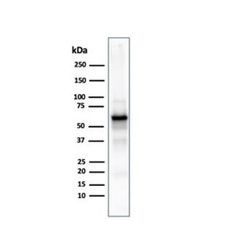 AKT1 Antibody