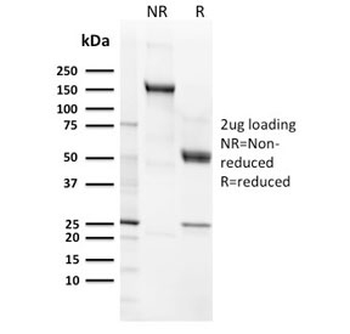 CD21 Antibody