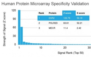 Estrogen Receptor beta Antibody