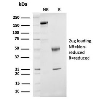 Estrogen Receptor beta Antibody