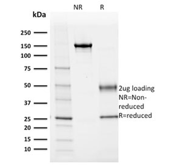 Albumin Antibody / ALB