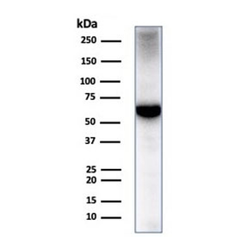 Albumin Antibody / ALB