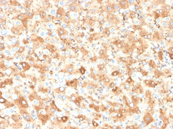 Albumin Antibody / ALB