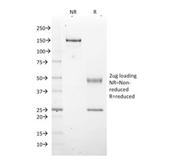 EZH2 Antibody