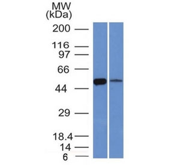 ALDH1A1 Antibody / Acetaldehyde dehydrogenase 1