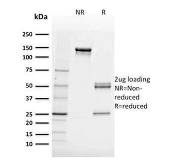 FABP5 Antibody (epidermal)