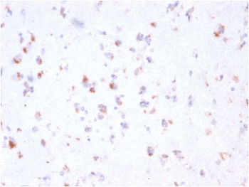 FCGRT Antibody