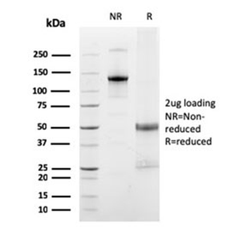 FCGRT Antibody