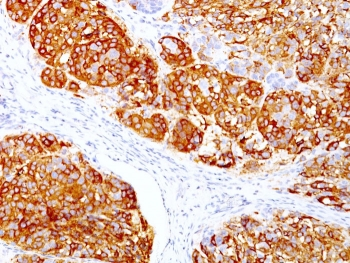 MART-1 Antibody Cocktail / Melan-A