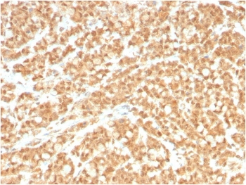ICOS-L Antibody / ICOS Ligand / B7RP-1