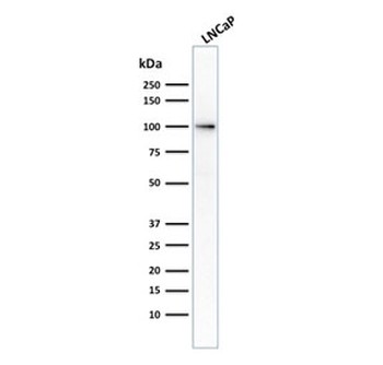Folate Hydrolase 1 Antibody / FOLH1 / PSMA