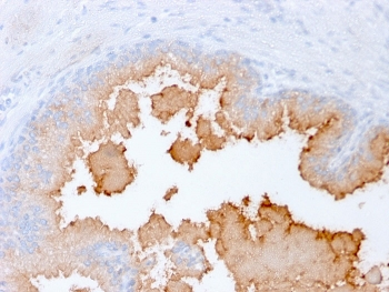 AMACR / p504S Antibody (Prostate Cancer Marker)