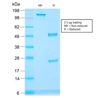 AMACR / p504S Antibody (Prostate Cancer Marker)