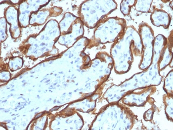 EGF Receptor / EGFR Antibody