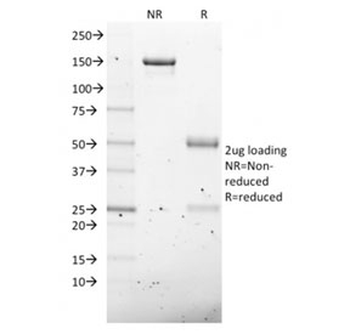 NKX2.8 Antibody