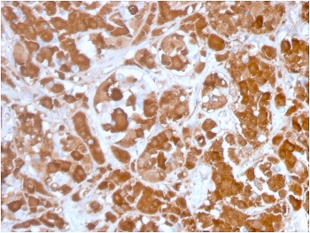 Growth Hormone Antibody / GH1