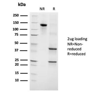 Growth Hormone Antibody / GH1