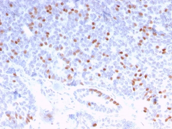 Estrogen Receptor alpha Antibody