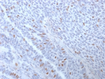 Estrogen Receptor alpha Antibody