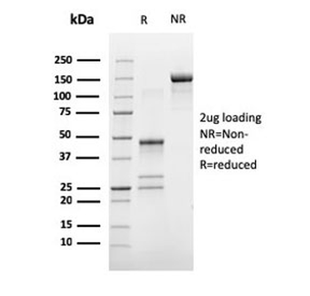 Estrogen Receptor alpha Antibody