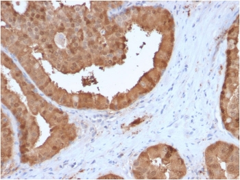 GLO1 Antibody / Glyoxalase I