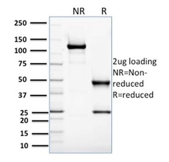 GLO1 Antibody / Glyoxalase I