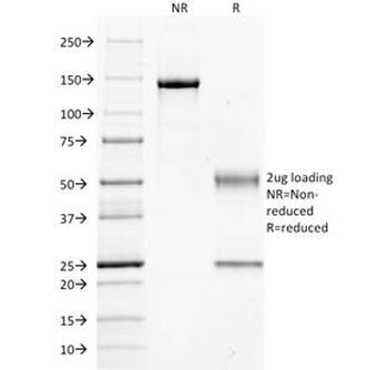 GNAQ Antibody