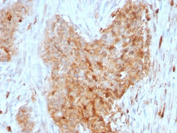 GPI Antibody / Glucose-6-phosphate isomerase