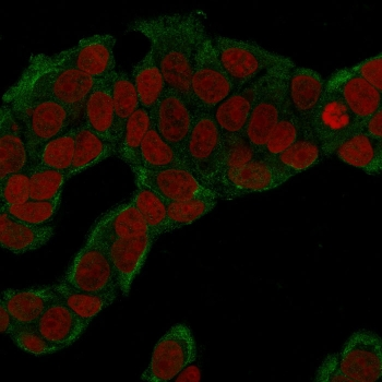 GPI Antibody / Glucose-6-phosphate isomerase