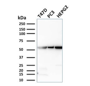 GPI Antibody / Glucose-6-phosphate isomerase