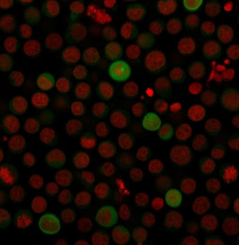PD-L1 Antibody / B7-H1 / CD274