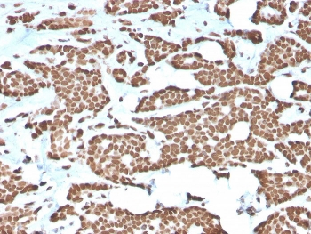 Histone H1 Antibody