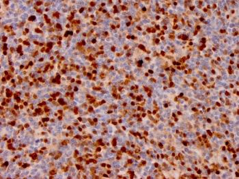 Annexin A1 Antibody