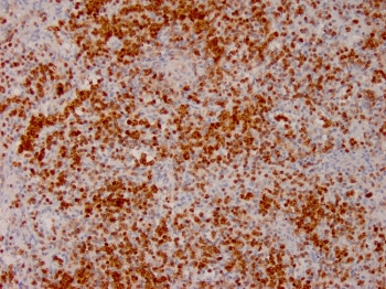 Annexin A1 Antibody