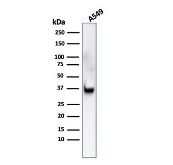 Annexin A1 Antibody