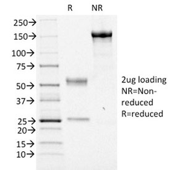 FOXA1 Antibody