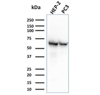 HSP60 Antibody