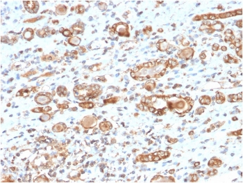 HSP60 Antibody