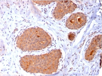 HSP60 Antibody