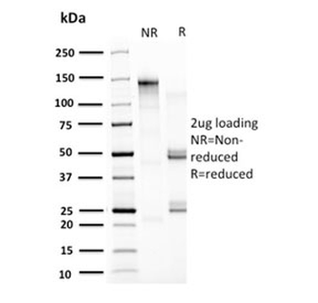 HSP60 Antibody