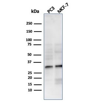 Recombinant NKX2.8 Antibody