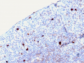 IgM Heavy Chain Antibody