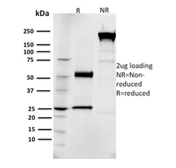 EGF Receptor / EGFR Antibody