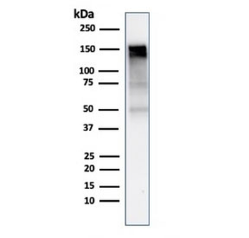EGF Receptor / EGFR Antibody