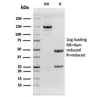 EGF Receptor / EGFR Antibody