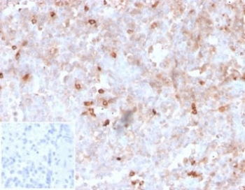 Lambda Light Chain Antibody / Lambda Antibody