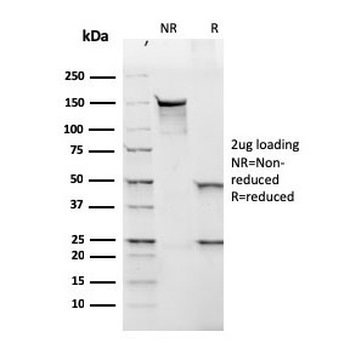 Lambda Light Chain Antibody / Lambda Antibody